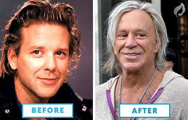 Click image for larger version

Name:	Mickey-Rourke-Botched-Plastic-Surgery-10-Failed-Celebrity-Plastic-Surgeries.jpg
Views:	1
Size:	135.8 KB
ID:	97140