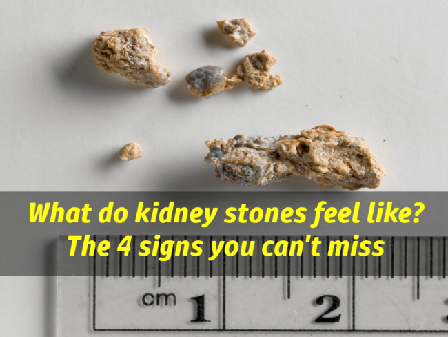 what-do-kidney-stones-feel-like-signs-of-kidney-stones-1760010352.png